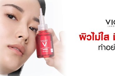 จุดด่างดำ Vichy