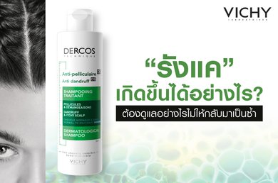 acne-and-stress-tips-for-keeping-calm-and-taking-control