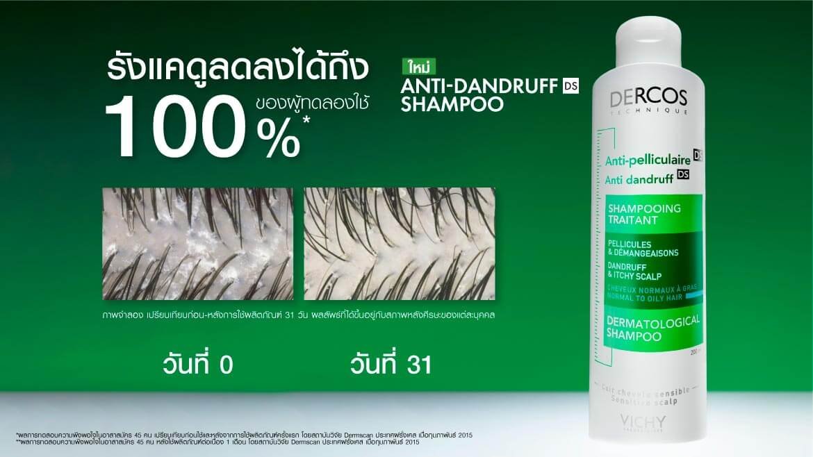 รังแค สาเหตุ
