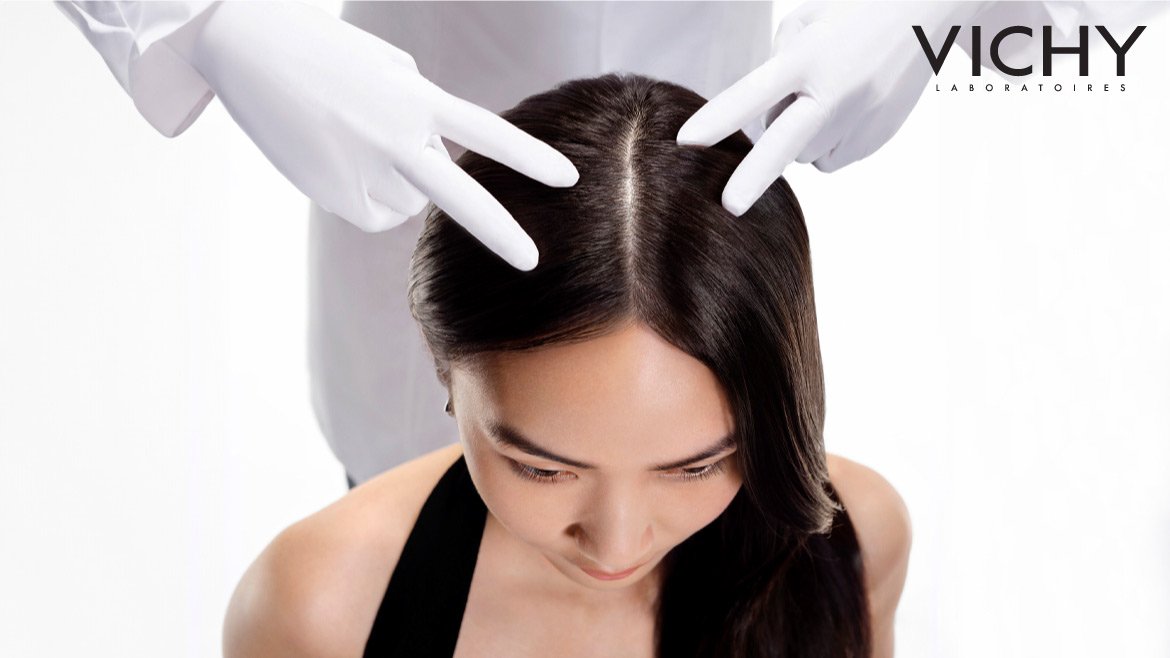 แชมพูขจัดรังแคเชื้อรา