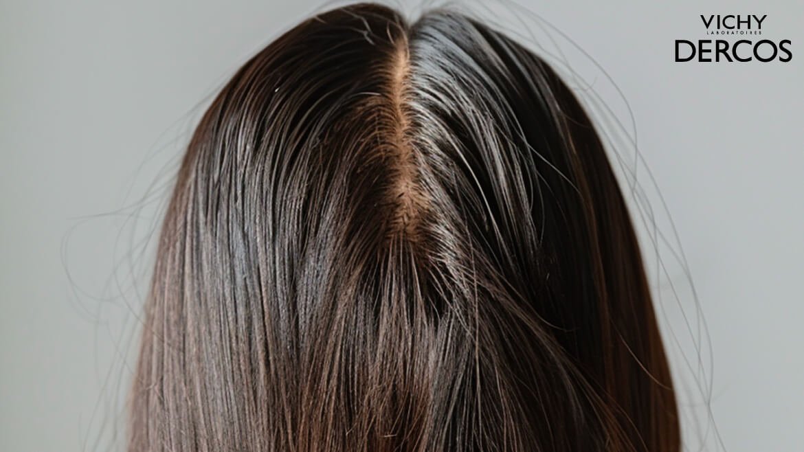 ผมมันง่าย อากาศเย็น