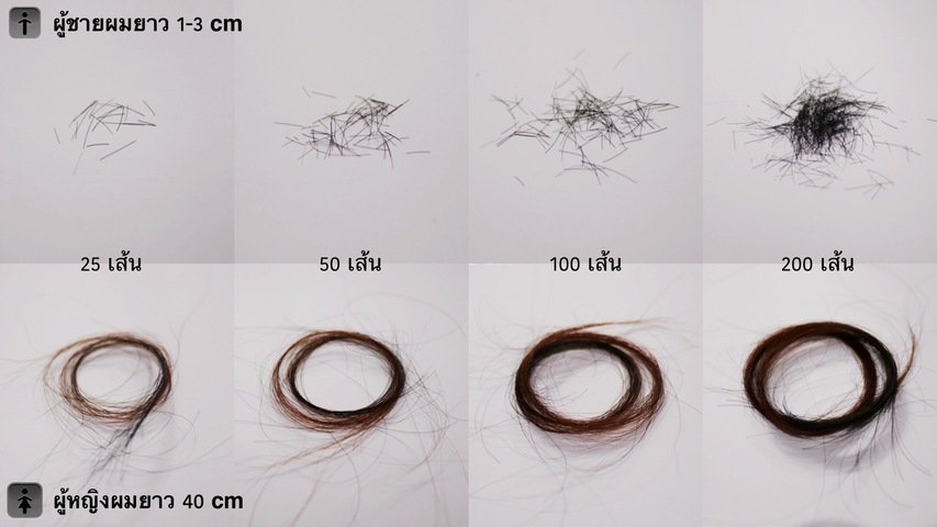 ผมร่วง
