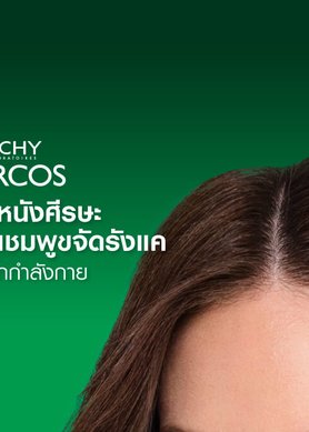 แชมพูขจัดรังแค ดูแลหนังศีรษะ