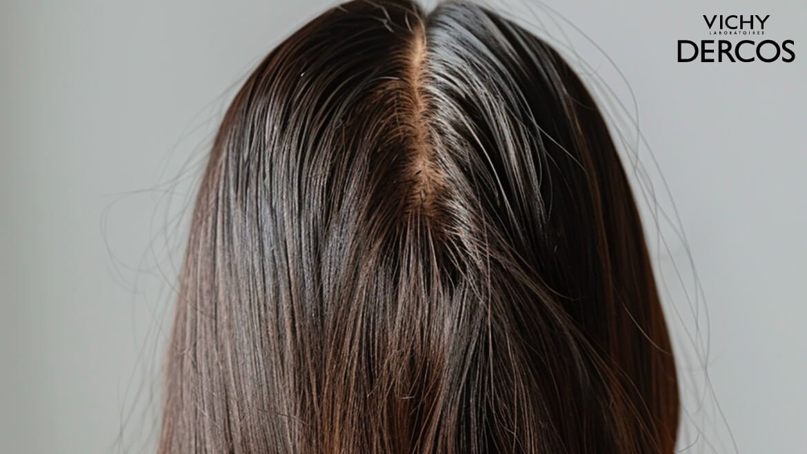 ผมมันง่าย เกิดจาก