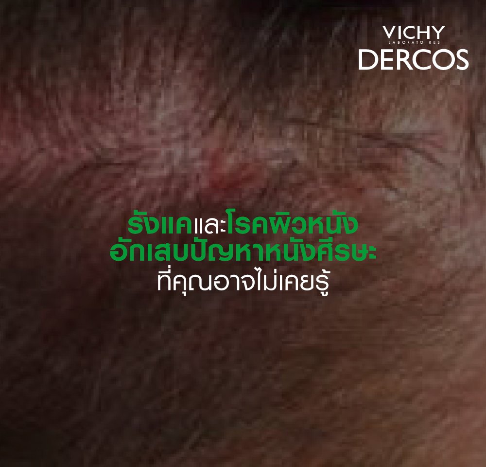 shampoo-protect-dandruff-hair-problem