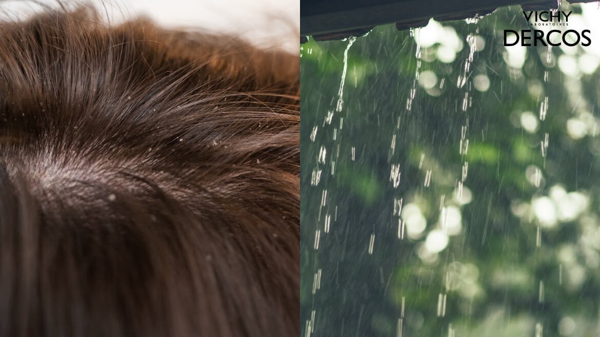 หน้าฝน แชมพูขจัดรังแค Vichy