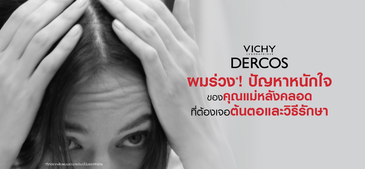 postpartum-hair-loss-causes-treatment