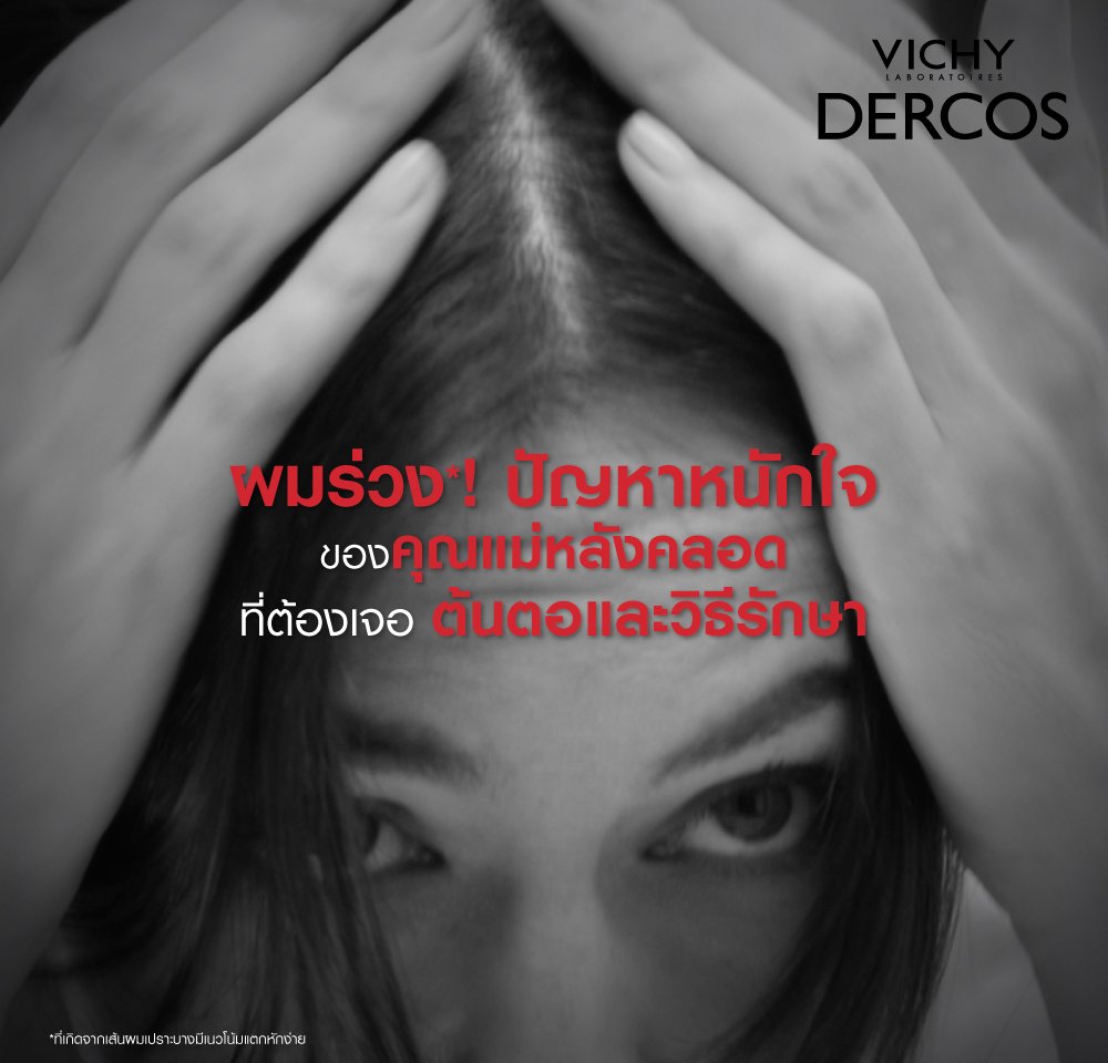 postpartum-hair-loss-causes-treatment