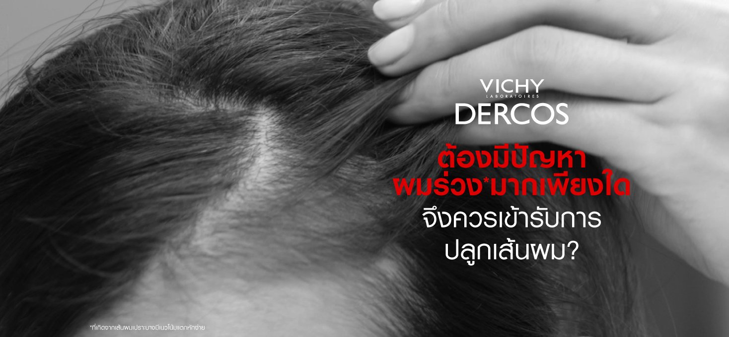 solve-problem-of-hair-loss