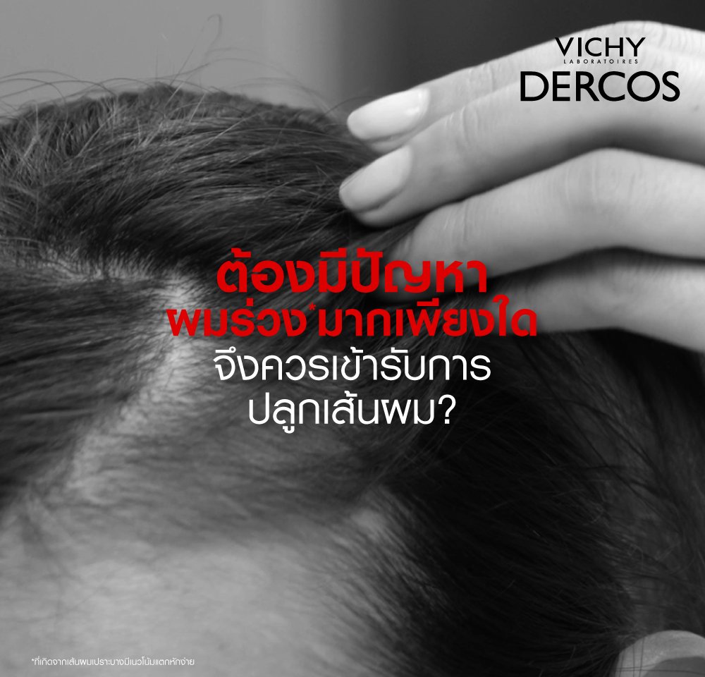 solve-problem-of-hair-loss