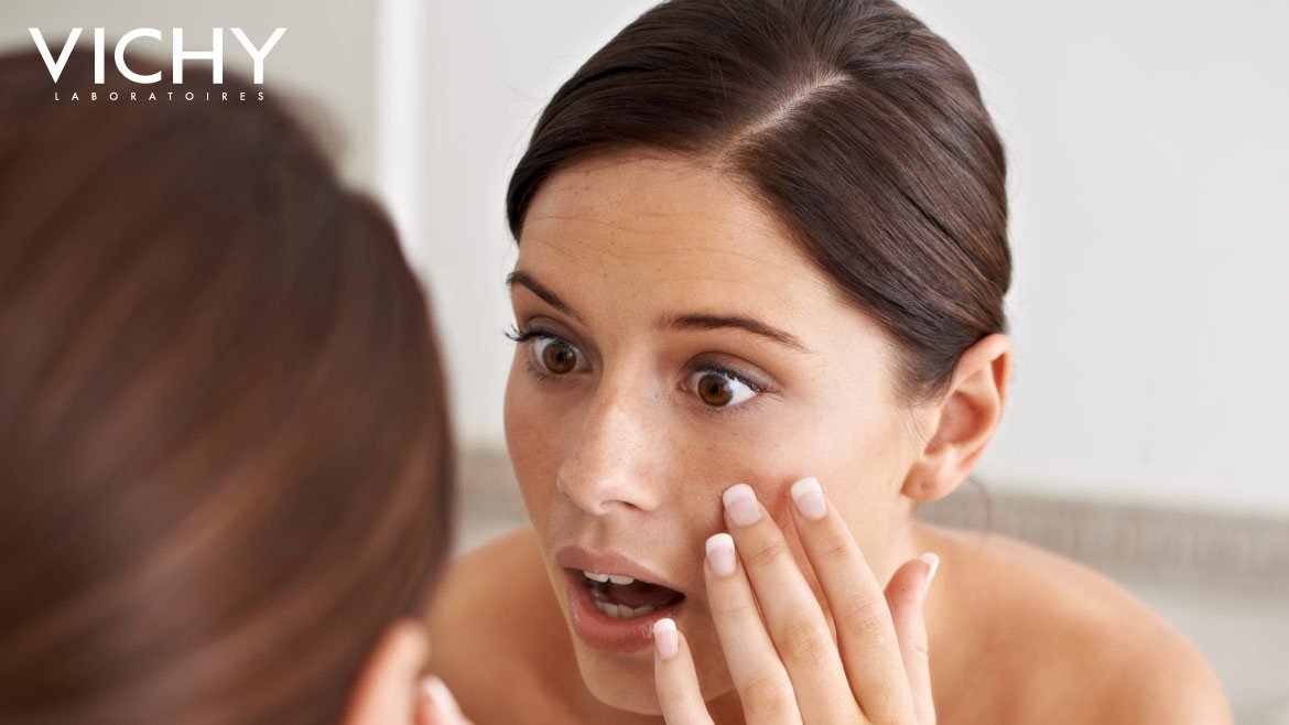 สาเหตุผิวหมองคล้ำ