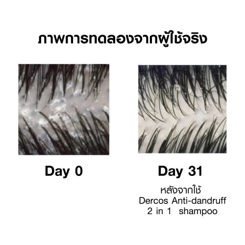 แชมพูผสมครีมนวด