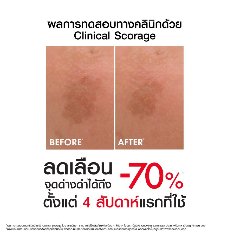 VICHY_LIFTACTIV_SPECIALIST_SERUM_B3