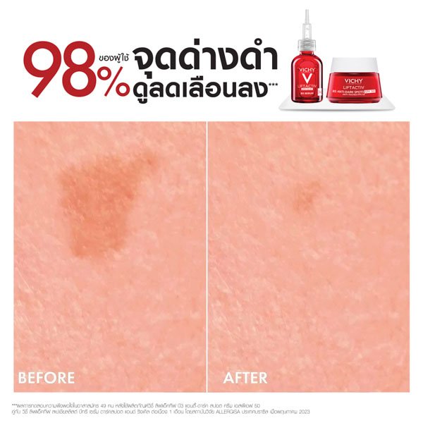 liftactiv-anti-ageing-day-cream-pack4