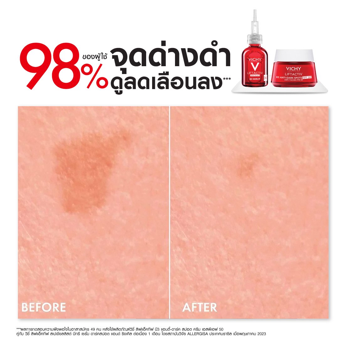 liftactiv-anti-ageing-day-cream-pack5